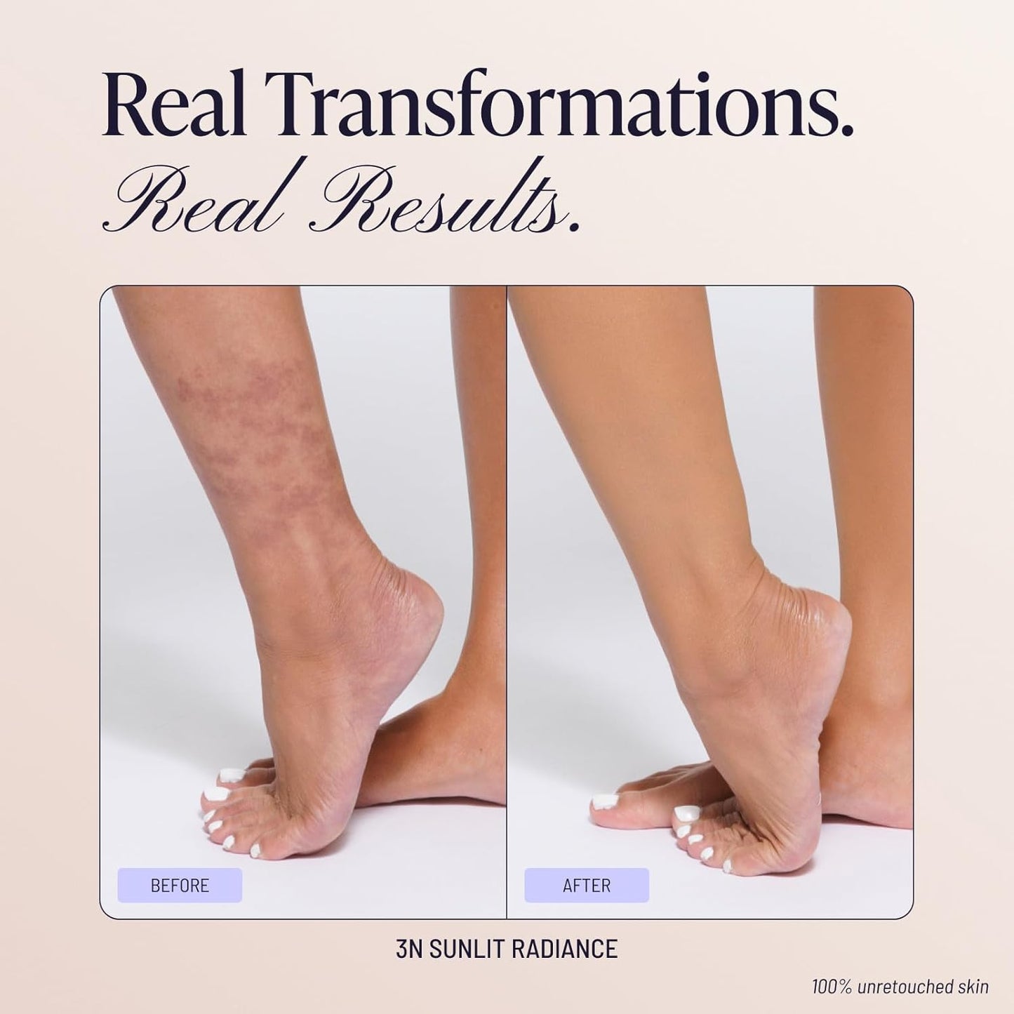 Roselit Signature™ Body Coverage Perfector